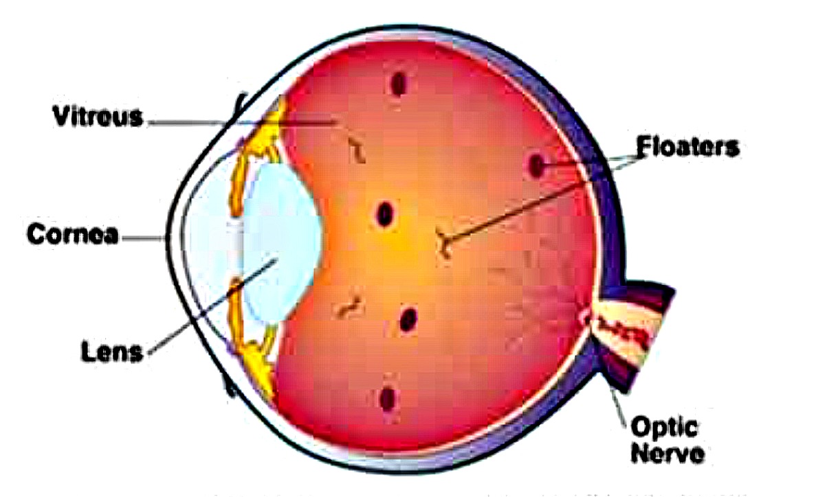 Eye Floaters | Happy Eyesight